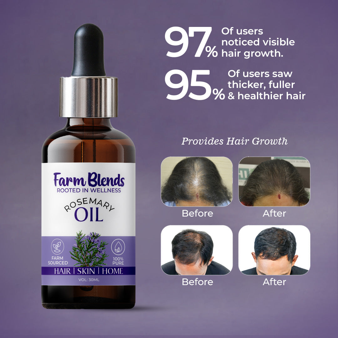 Pure Spanish Rosemary Essential Oil